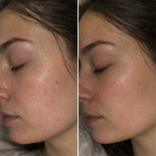 Redvexa™ LED Facial Beauty Mask