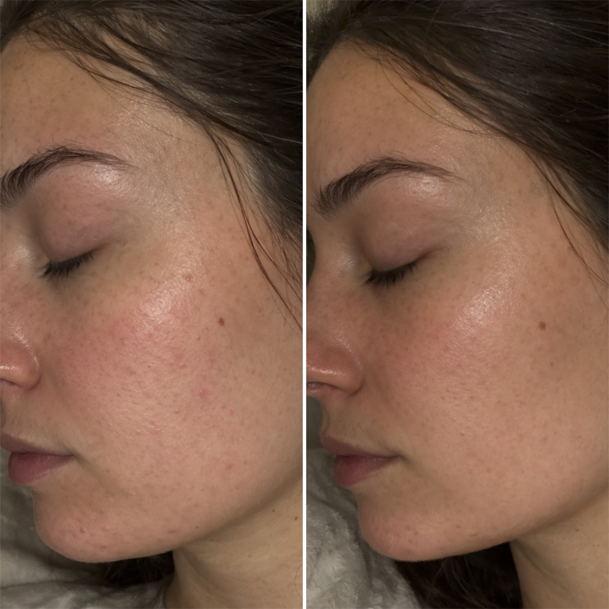 Redvexa™ LED Facial Beauty Mask